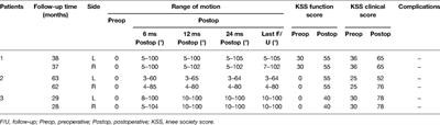 Combination of Fusiform Capsulectomy of the Posterior Capsule and Percutaneous Flexion Tendon Release in the Treatment of Fused Knee with Severe Flexion Contracture During Total Knee Arthroplasty—A Report of Six Cases